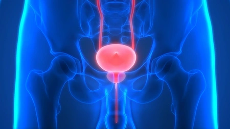 prostate cancer treatment with dendritic cells