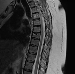 spinal thoracic surgery hospitals in Germany - GermanyHealth
