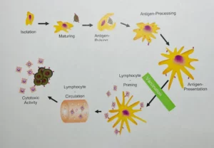 proste cancer treatment with dendritic cells in Germany