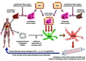 dendritic cell therapy in Germany